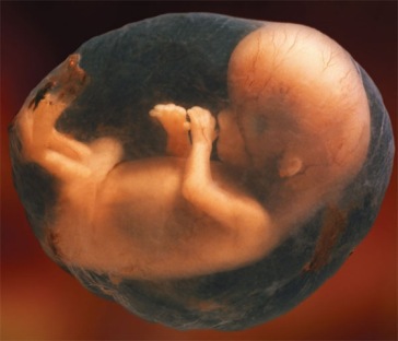 baby girl fetus